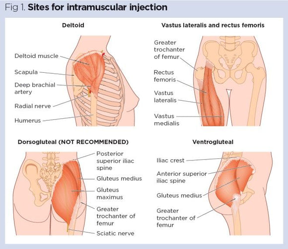 Intramuscular Injection Sites